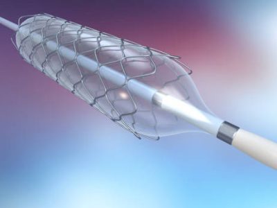 titanium in Cardiovascular Interventional Devices